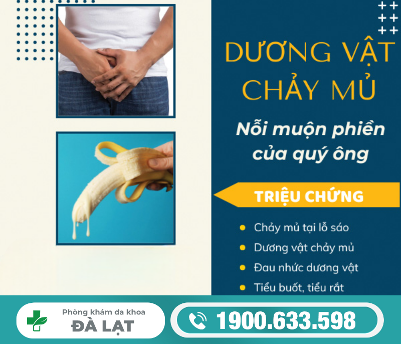 Hình ảnh minh họa